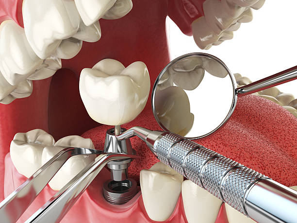 Best Emergency Dental Care for Sports Injuries in New Kingman Butler, AZ